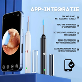 Oorreiniger met Camera – Draadloze Oorreinigingscamera